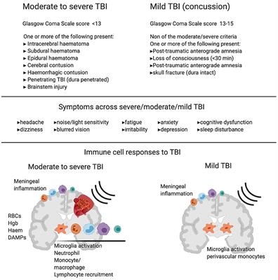 The Immune System's Role in the Consequences of Mild Traumatic Brain Injury (Concussion)